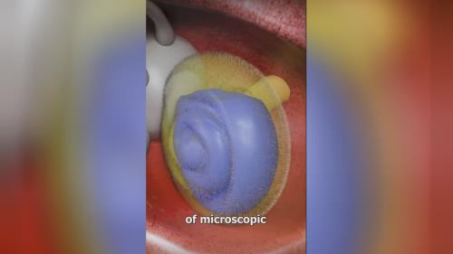 بهترین سمعک اصفهان