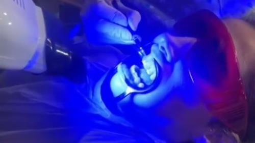 ایمپلنت دندان در جردن